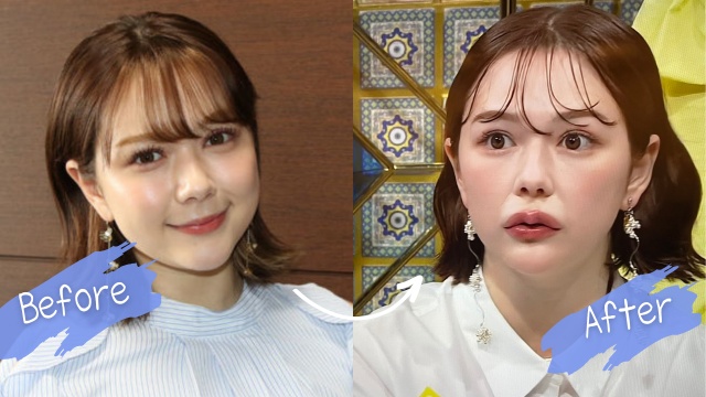 【画像比較】村重杏奈の唇は前と変わった？整形ではなくオーバーリップ？