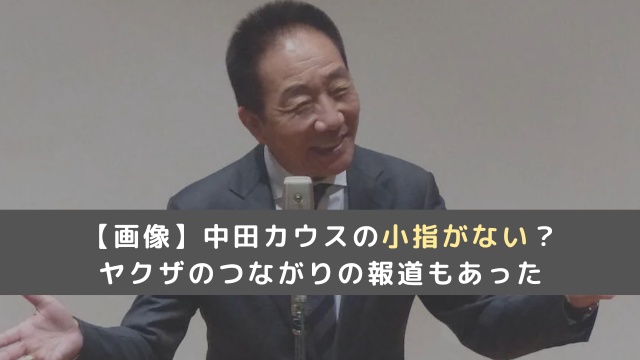 【画像】中田カウスの小指がない？ヤクザのつながりの暴露や報道もあった